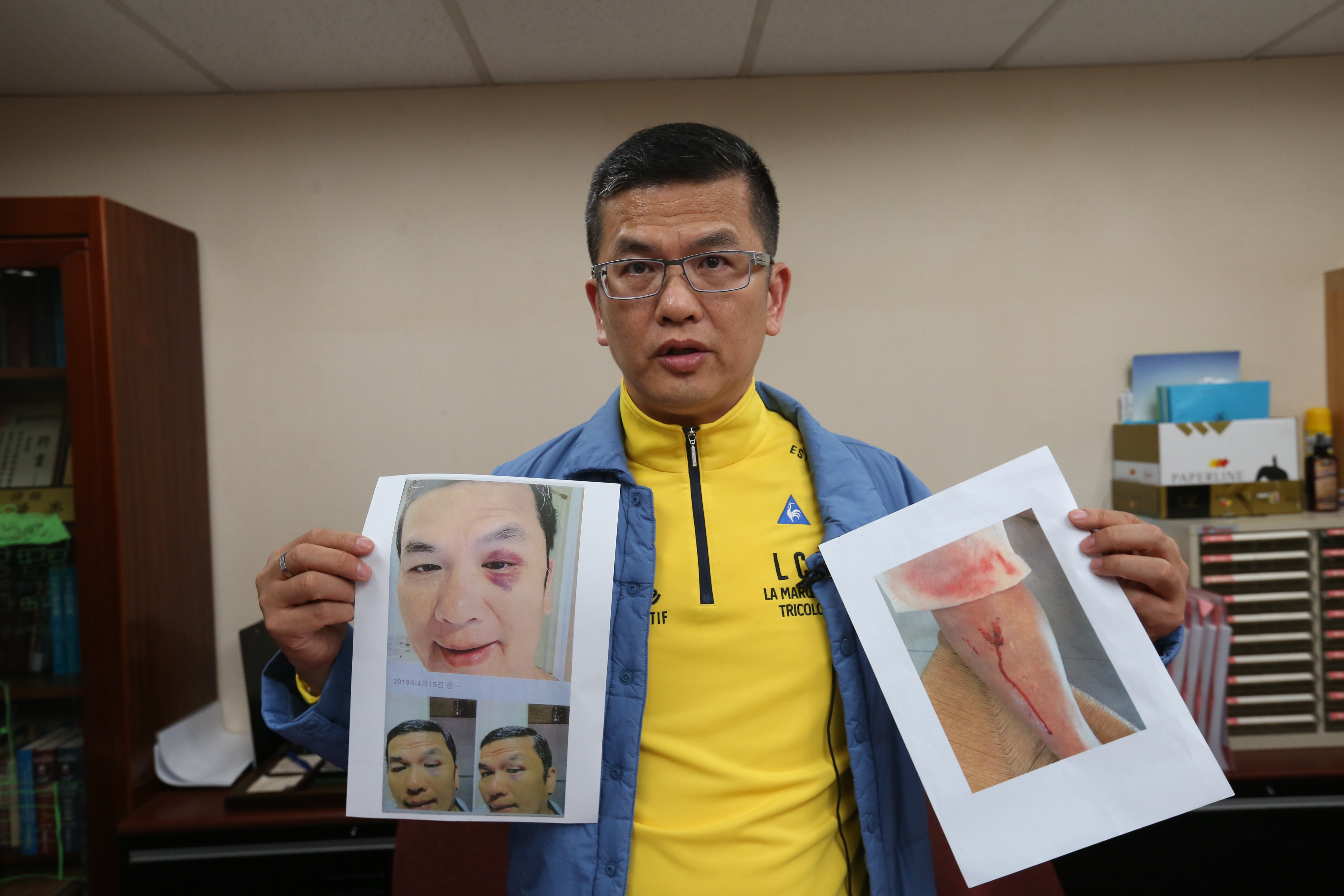 鍾俊榮去年4月遭小兒子鍾鼎興施暴，導致眼部微血管破裂，已於同年10月提出告訴。