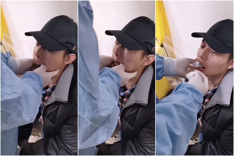 中國歌手霍尊打哈欠導致下巴脫臼，半夜掛急診影片曝光。（翻攝自霍尊微博）