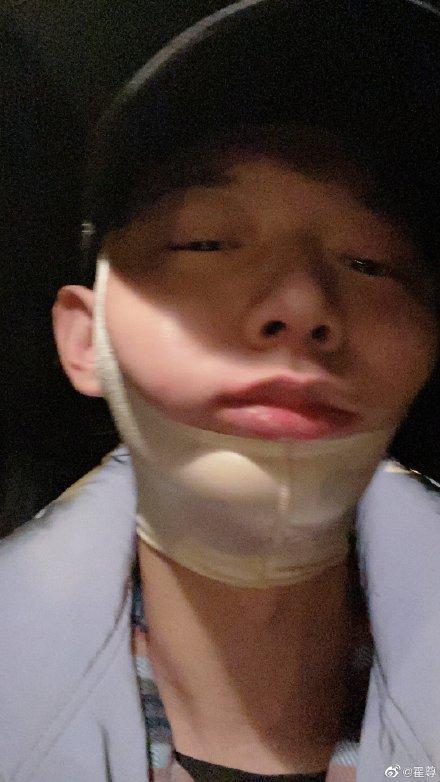 霍尊下巴纏上繃帶固定,粉絲要他好好保重身體。(翻攝自霍尊微博)