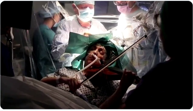 英國女子在進行大腦手術時演奏小提琴。（翻攝自Reuters twitter）