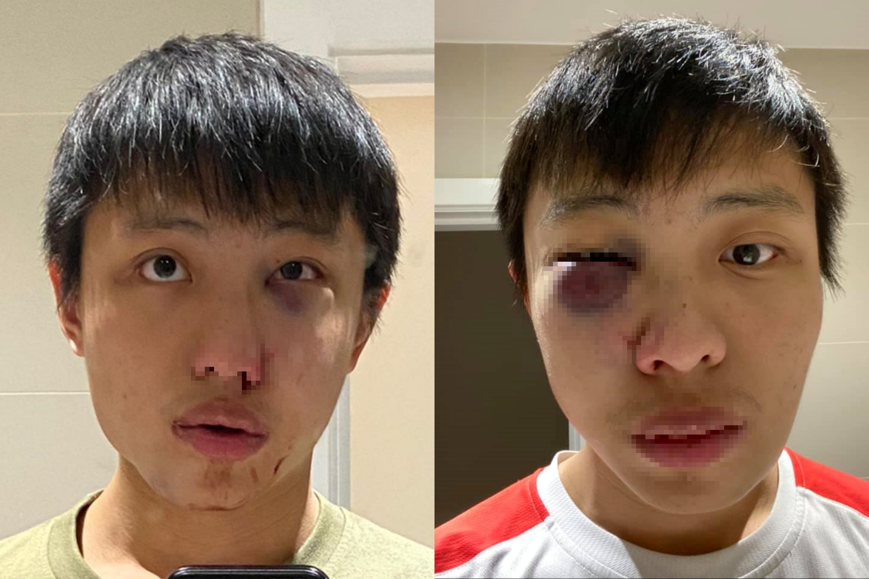 新加坡男子在倫敦遭到因種族暴力而起的暴力攻擊。（翻攝自臉書）