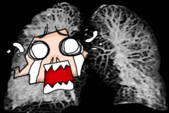 羅馬的國家傳染病研究所最近曝光「新冠肺炎」的肺部X光、電腦斷層掃描照。（翻攝自arynews.tv）