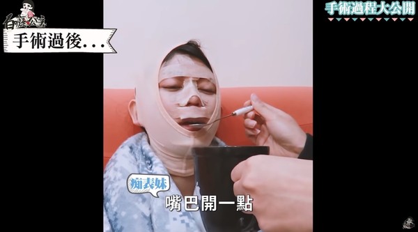 白癡公主臉部纏滿繃帶，得靠家人餵食食物。（翻攝自YouTube白癡公主）