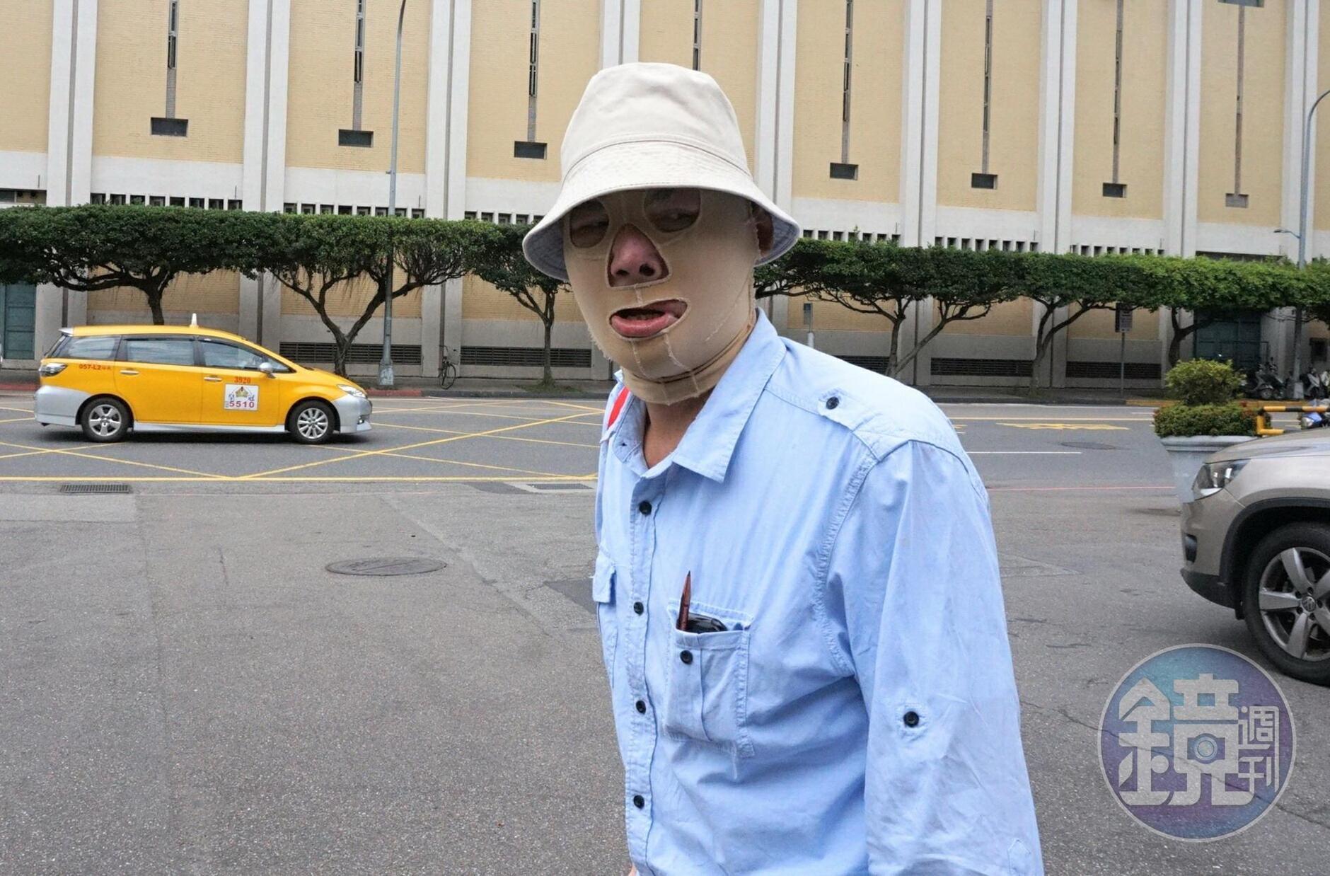 翁家四子翁仁平為了搶救父母,自己也燒傷,出庭時還得穿壓力衣。