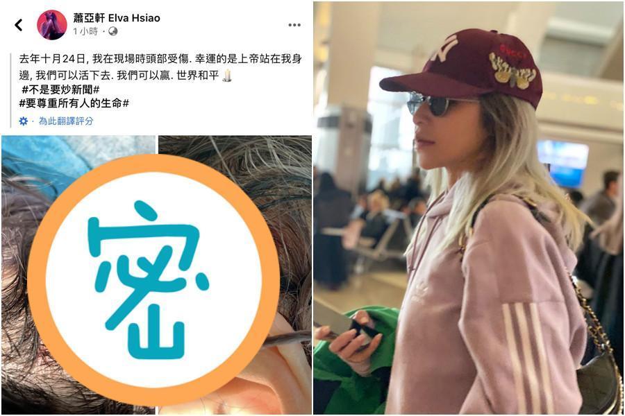 蕭亞軒3日深夜於社群網站貼出頭部受傷的照片，一條長而深的傷痕，看了怵目驚心。（翻攝自蕭亞軒臉書）