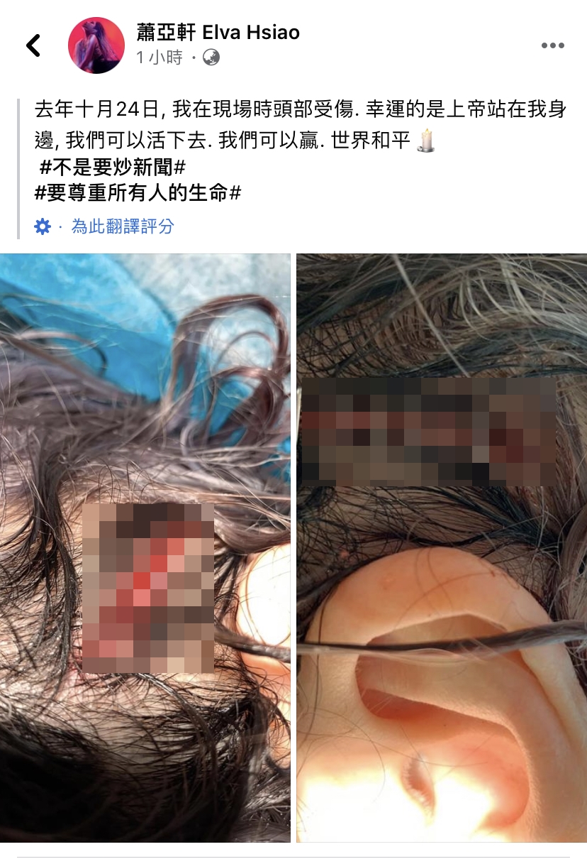 蕭亞軒突然曬出受傷照片。(翻攝自蕭亞軒臉書)
