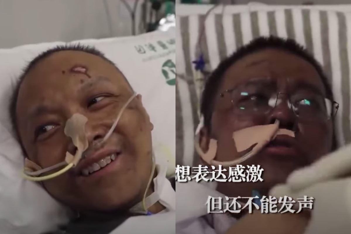 中國兩名染疫醫師臉部膚色轉為暗黑色。(翻攝自北京衛視YouTube)