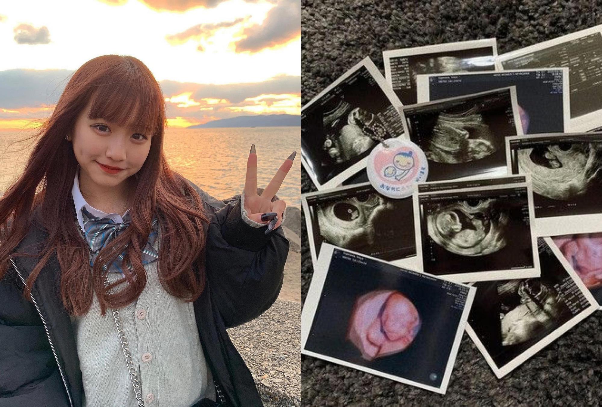 女高中生重川茉彌是戀愛實境節目班底之一,21日在社群網站公開多張超音波照宣布懷孕。(翻攝自重川茉彌推特)