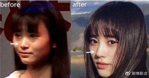 鞠婧禕過去的樣貌十分扁平，與現在十分不同。（翻攝劇情劇點微博）