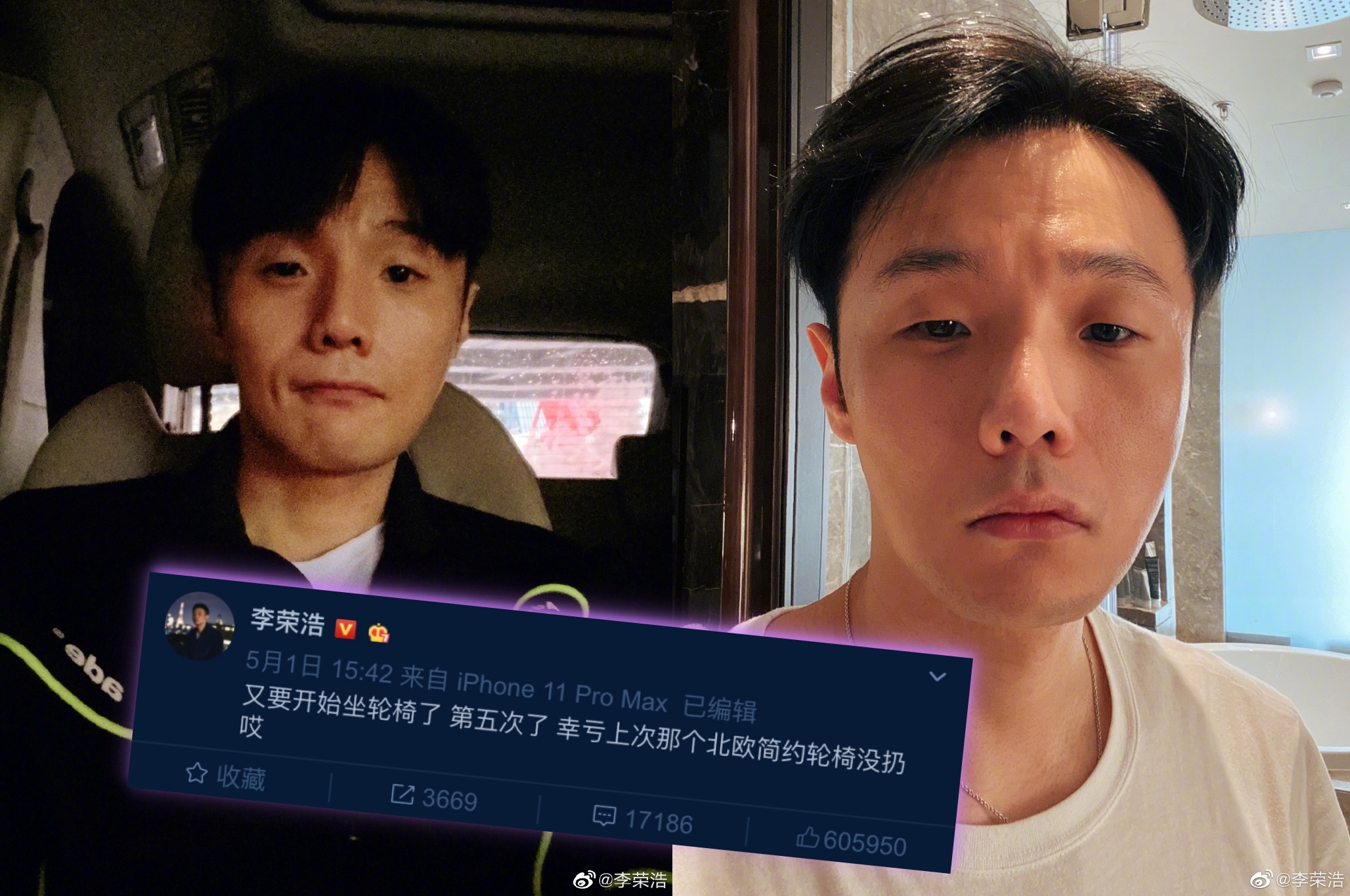 李榮浩在微博自爆腿傷要坐輪椅。（翻攝李榮浩微博）