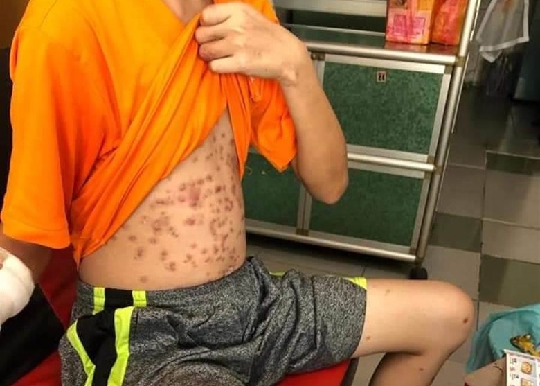 彰化一名單親少年原本為幫補家計而北上工作，不料卻慘遭無良僱主虐待。（翻攝彰化踢爆網）