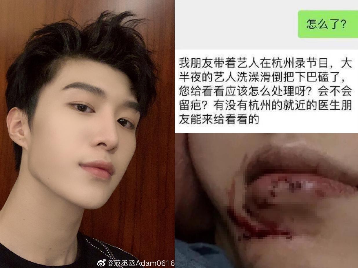 范丞丞半夜洗澡摔傷下巴，經紀人微信求助朋友圈。（翻攝自新浪微博）