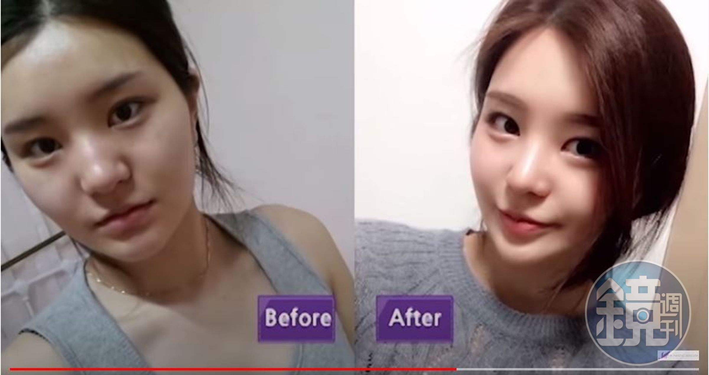 韓國女性整容率高，平均每三個女人就有一個選擇在30歲前整容，帶動韓國成為全球整型之都。（翻攝JW Plastic Surgery Korea）