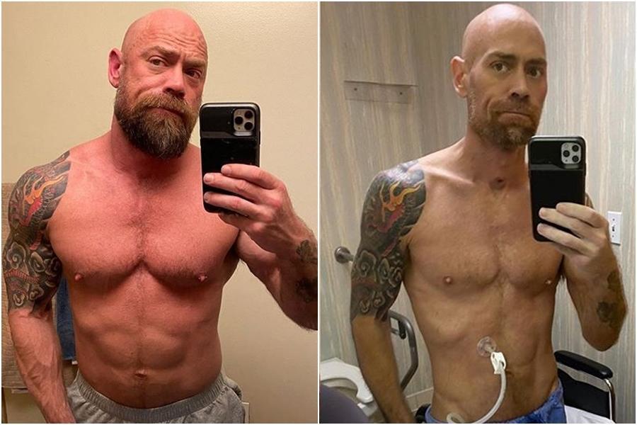 美國一名男護理師舒瓦茲（Mike Schultz）染疫後暴瘦23公斤。（翻攝自IG：thebearded_nurse）