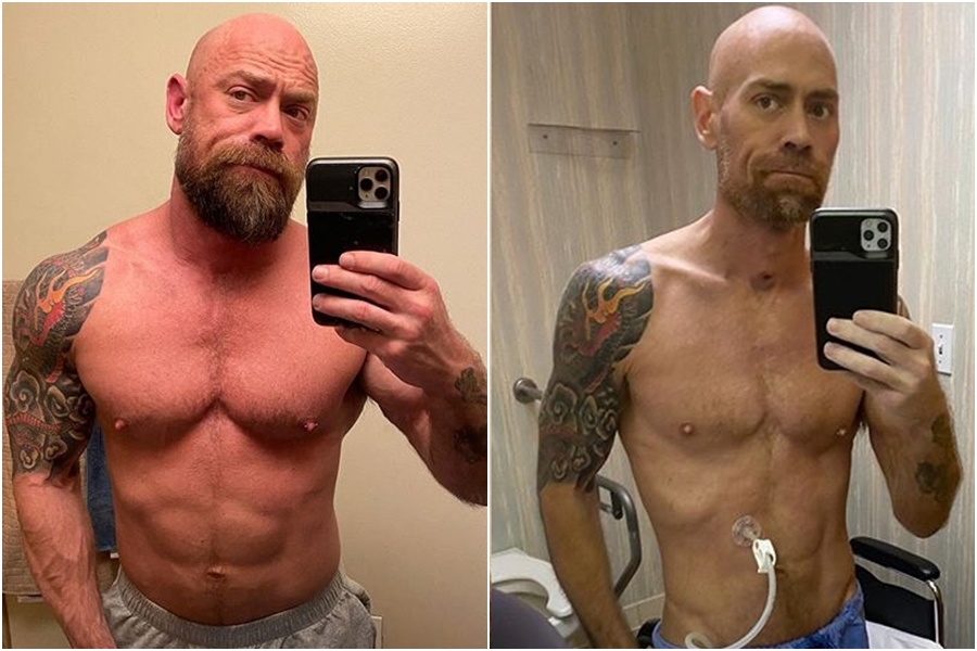 美國一名男護理師舒瓦茲（Mike Schultz）染疫後暴瘦23公斤。（翻攝自IG：thebearded_nurse）