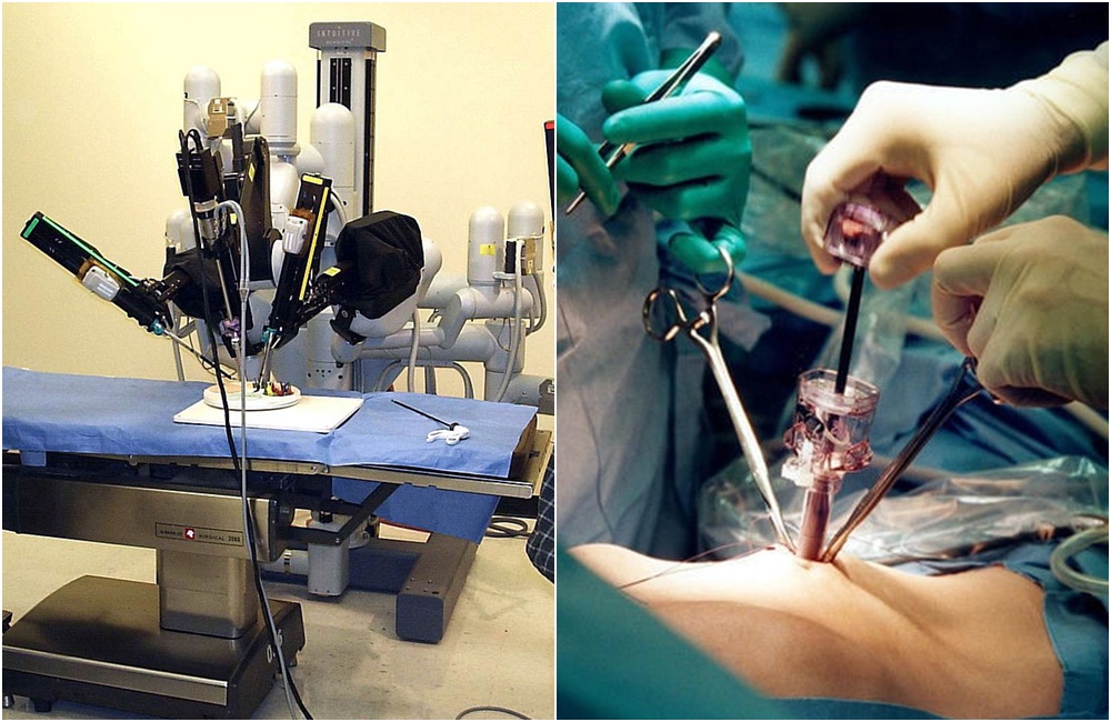 達文西手臂能協助醫師進行更複雜、高精準度和高靈活度的手術，精準的切除、修復和縫合，並且盡可能保留重要的神經、血管和正常的器官。（翻攝畫面）