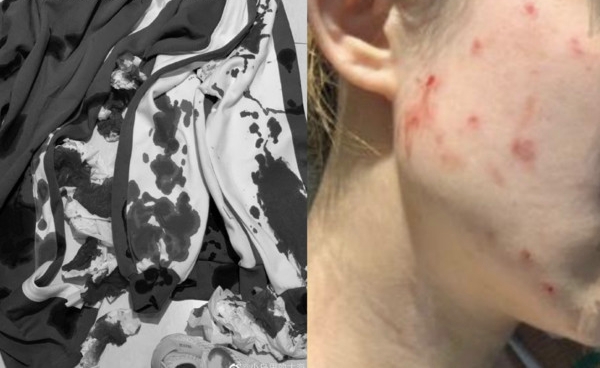 一名女子為了引起大眾關注,蓄意謊報女兒在學校受虐。(圖翻攝自微博)