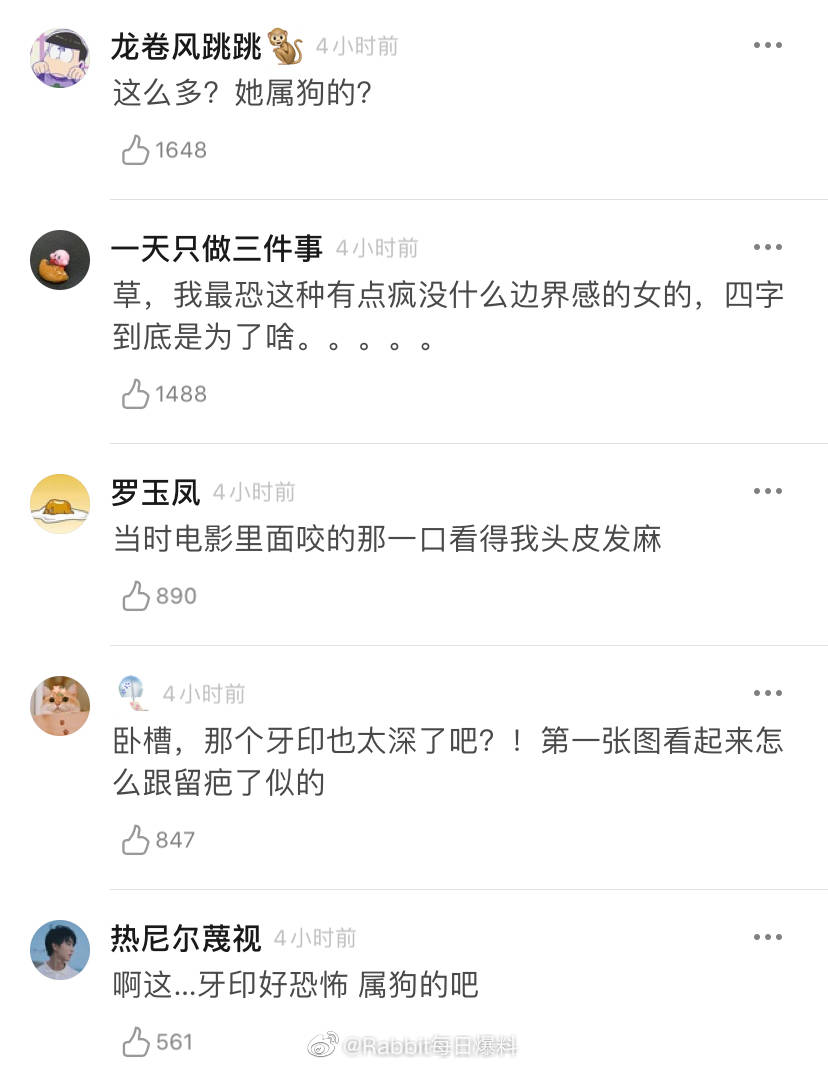 周冬雨拍《少年的你》時因劇情需要咬了同片演員的手臂,事隔一個月痕跡依舊存在。(翻攝自Rabbit每日爆料微博)