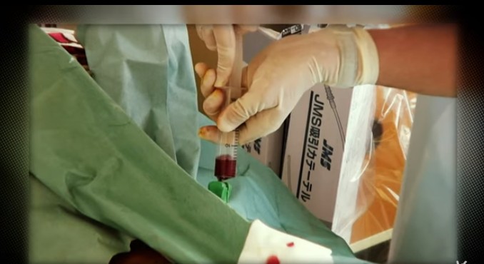 「再生醫療」近年被視為醫學界新一波的革命。（翻攝自公視《再生醫療》）