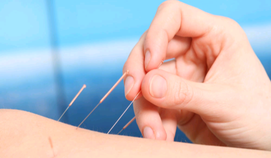 花蓮男子接受針灸調養身體,腳部蜂窩性組織炎送醫。(翻攝自百度)