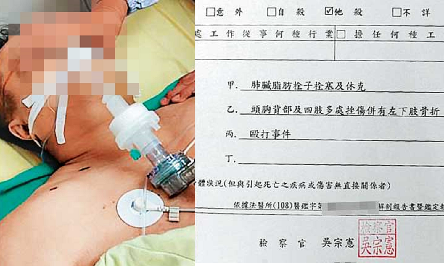 蔡男（圖）送醫後不治，法醫相驗後確認是遭毆打而他殺致死，案件至今發生快1年，吳宗憲遭家屬指控急著落跑當官，案件卻未偵結。（翻攝臉書爆料公社）