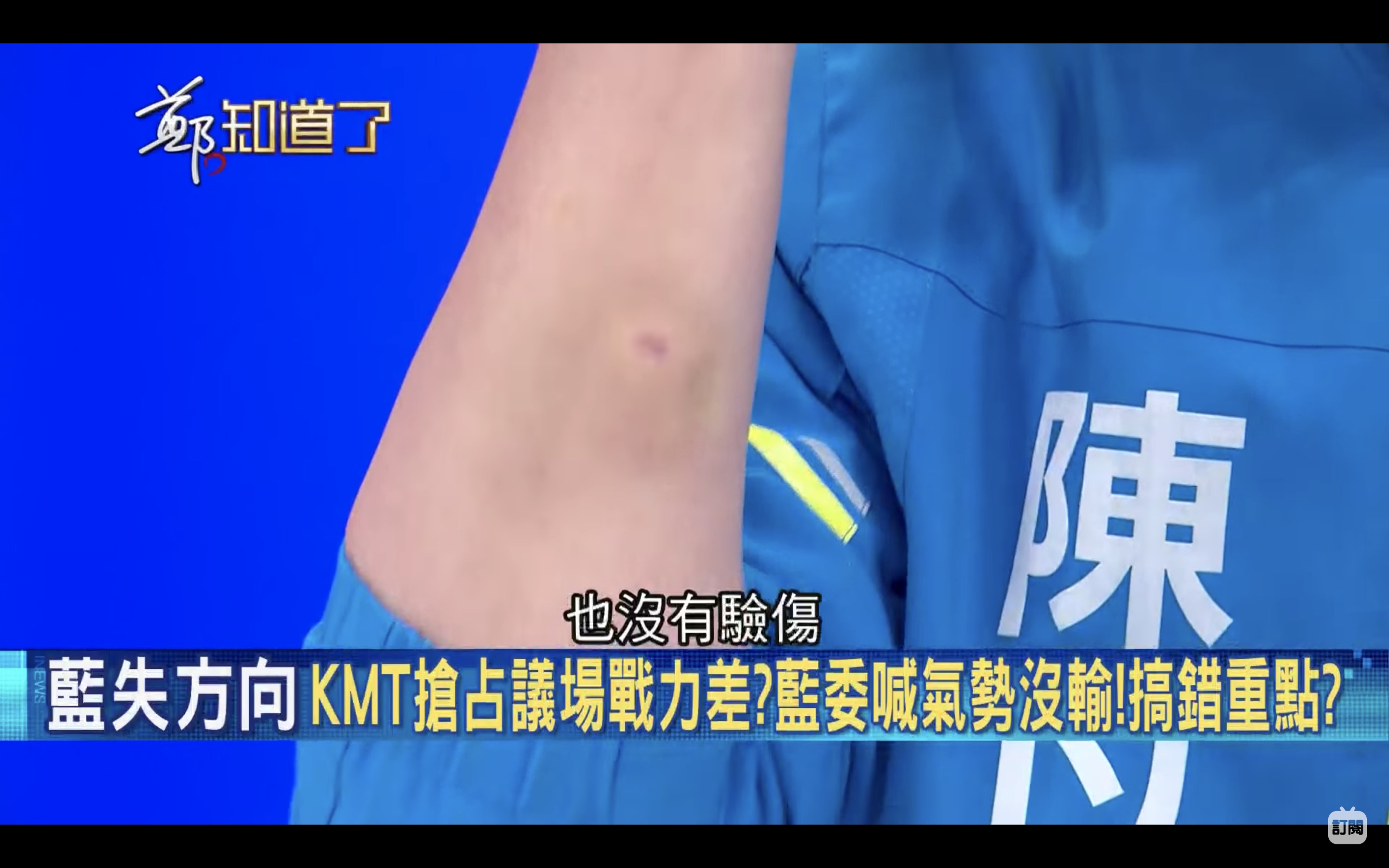 陳以信在談話節目秀出「皮開肉綻」的傷勢,卻只有一個小破皮。(翻攝三立《鄭知道了》Youtube頻道、)