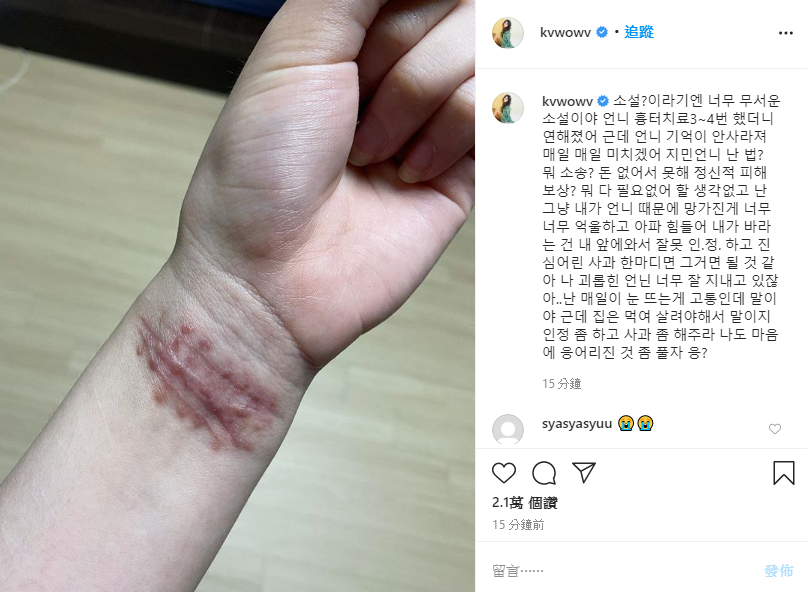 珉娥看到智珉疑嗆聲她捏造故事，PO出手腕傷痕照表示希望她可以道歉。（翻攝自珉娥IG）