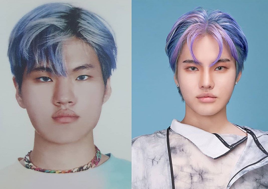 TAKUWA公開自己整形前後的照片，透露整形後更有自信。（翻攝TAKUWA IG）