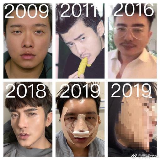 吳桐大方分享自己的換臉歷程。(翻攝吳桐微博)