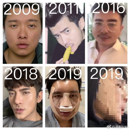 吳桐大方分享自己的換臉歷程。（翻攝吳桐微博）