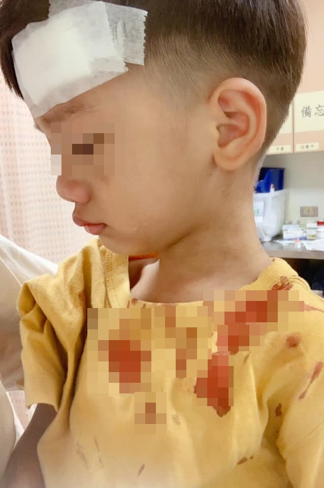 宥勝的兒子摔破頭,全身都是血。(翻攝自宥勝臉書)