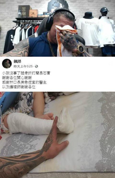 館長直播解釋兒子想玩溜滑梯,小孩不受控,甩開保母的手往前跑,意外被打球的人踩斷腳。(翻攝館長成吉思汗YouTube頻道)