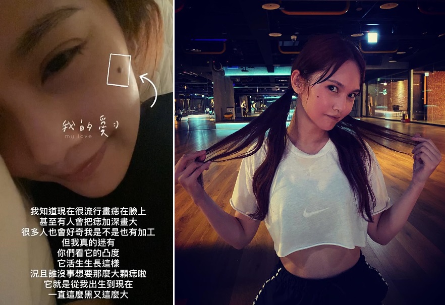 楊丞琳今（31日）凌晨在IG限時動態上，解釋臉上黑痣非加工。（翻攝自楊丞琳IG）