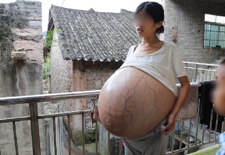 婦人搭公車時還被懷疑是否懷「多胞胎」,讓她難以解釋。(翻攝光明網)