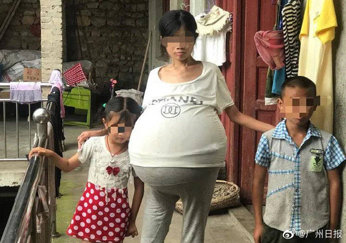育有兒女的婦人生活相當困苦，醫療費用對她來說相當沉重。（翻攝光明網）