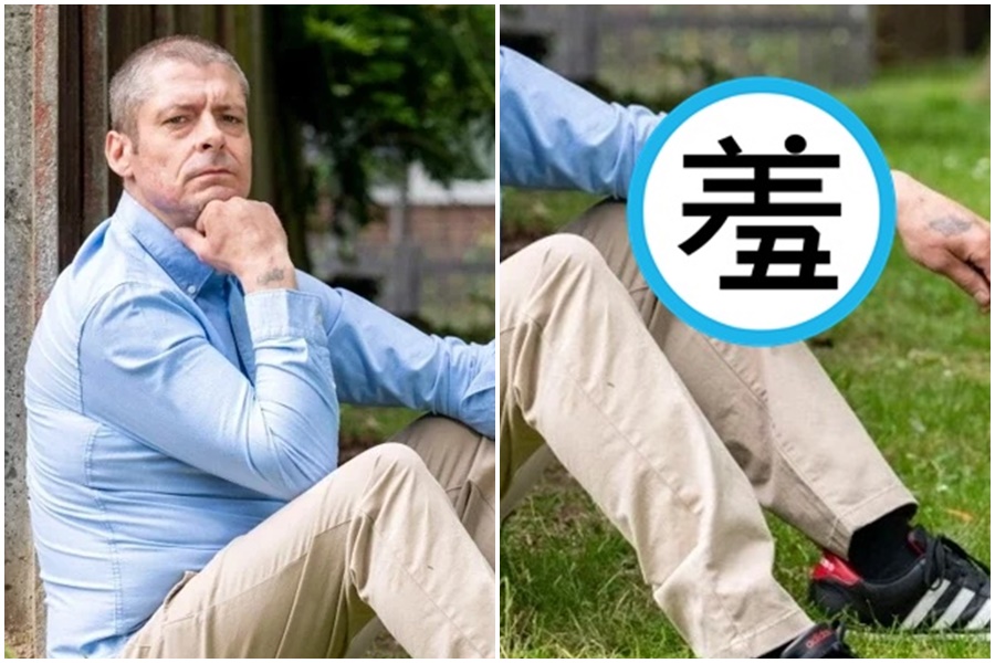 現年45歲的麥克唐納重建的生殖器在前手臂上。（翻攝自thesun.co.uk）