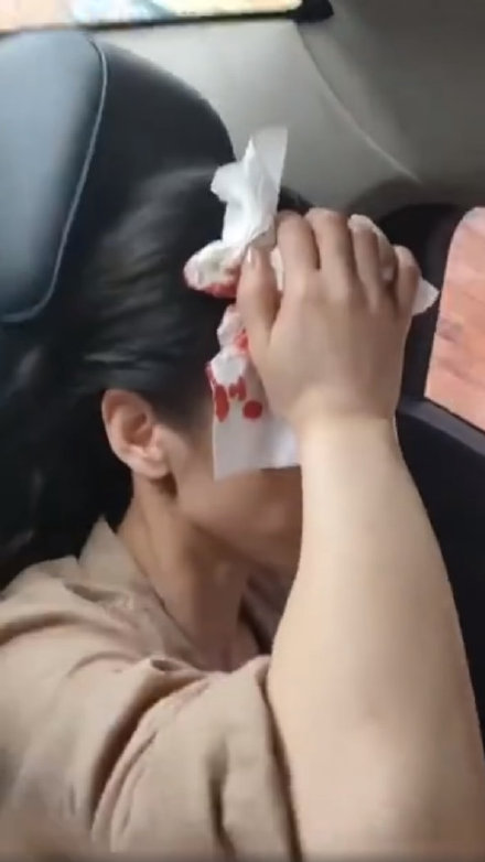 黃聖依也在拍戲時遭道具砸傷頭，按在傷口上的衛生紙點點血跡十分驚悚。（翻攝自黃聖依粉絲團微博）