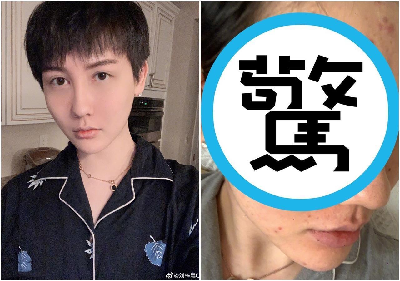 「蛇精男」(劉梓晨)暌違3個月更新微博,哭訴自己「全臉毀容」嚇壞網友。(翻攝自劉梓晨微博)