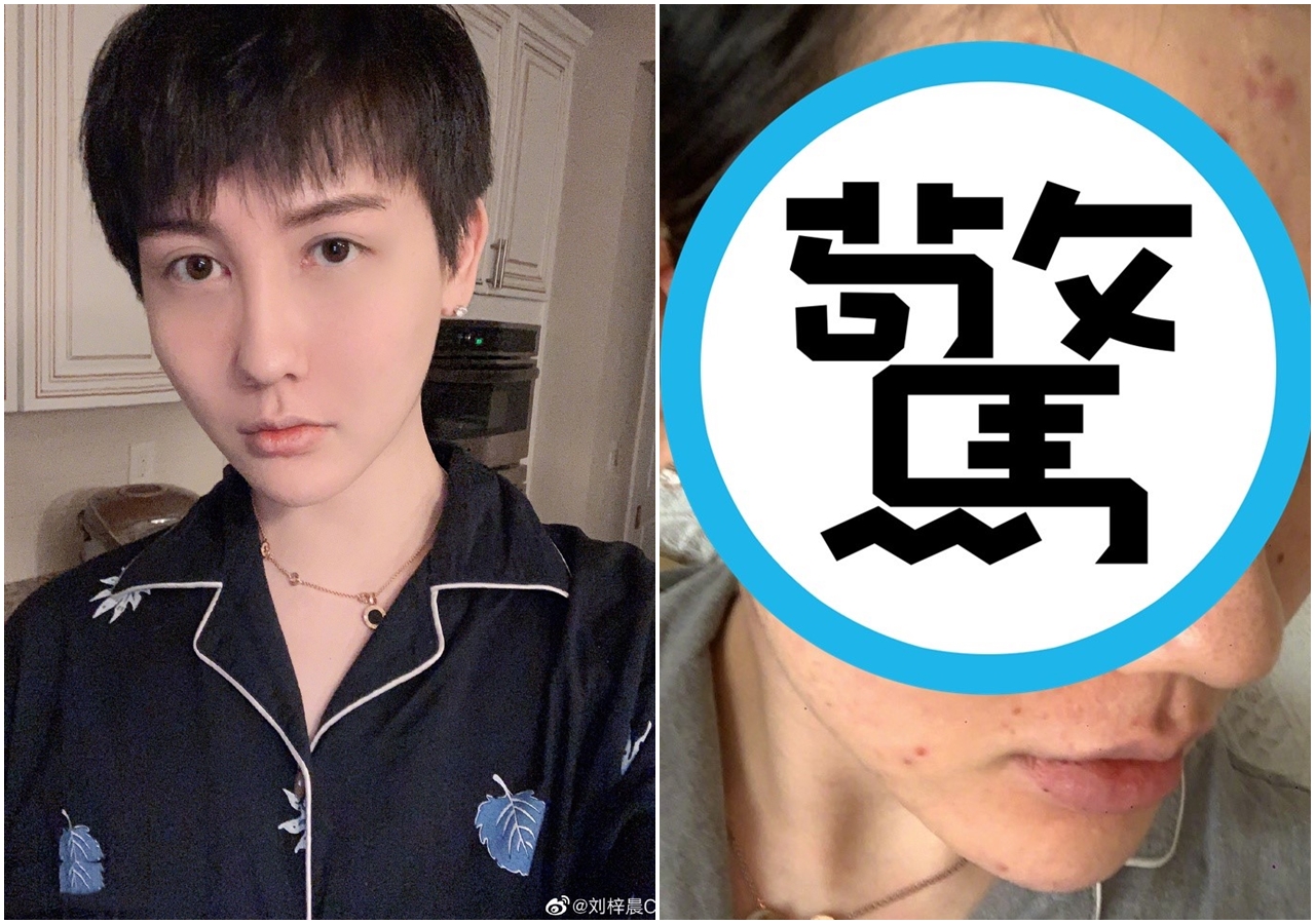 「蛇精男」（劉梓晨）暌違3個月更新微博，哭訴自己「全臉毀容」嚇壞網友。（翻攝自劉梓晨微博）