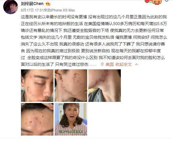 劉梓晨一連po出4張近照,表示自己正在經歷地獄般的生活。(翻攝自劉梓晨微博)