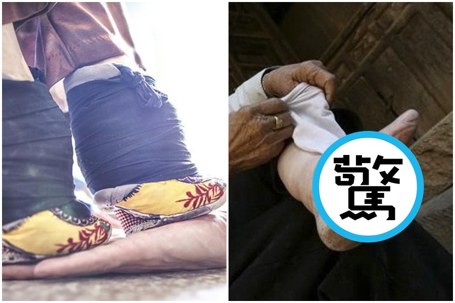 流行於宋朝到民國初期的「三寸金蓮」讓人嘆為觀止。（翻攝自微博）