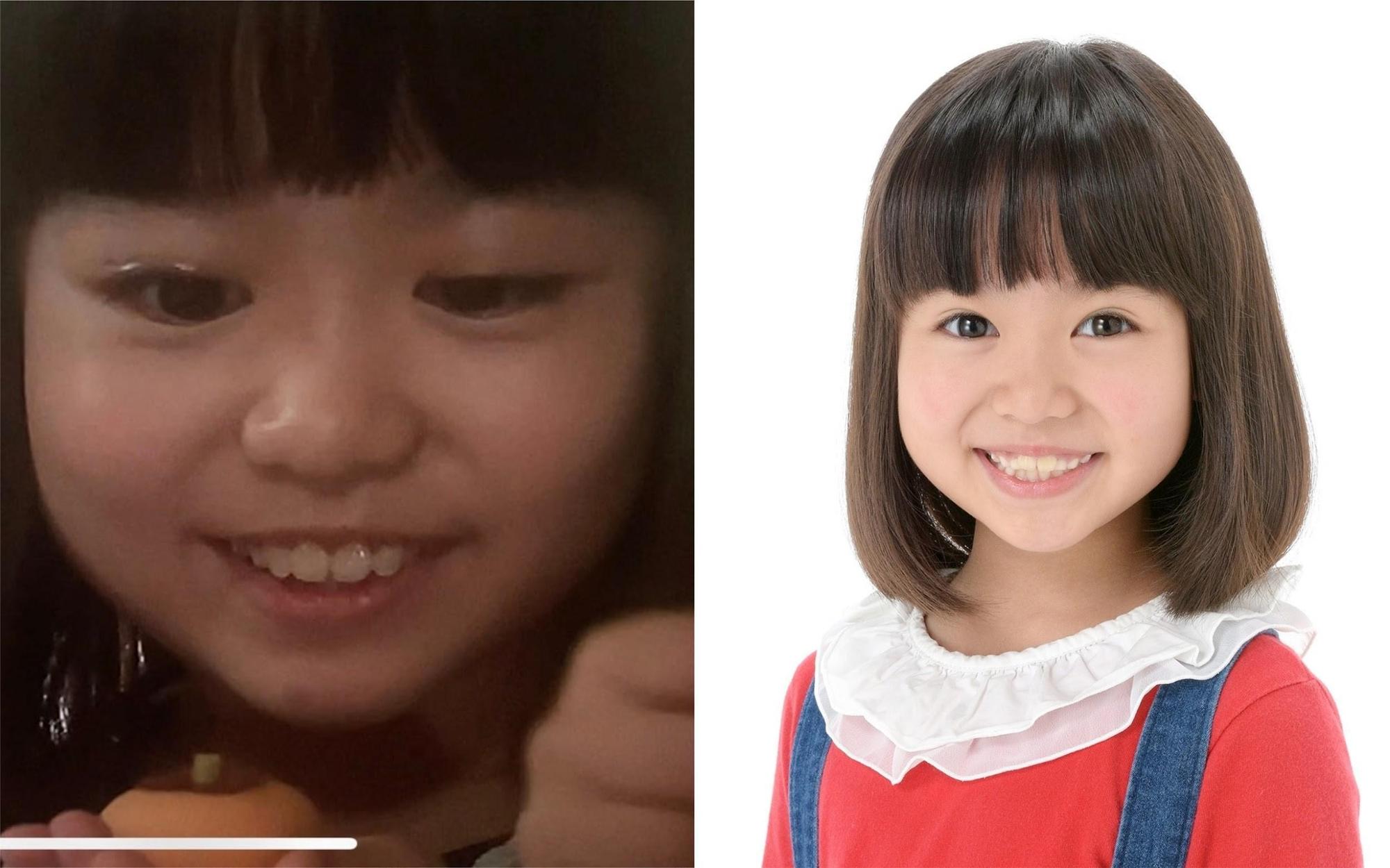 小童星宮崎步夢演出日劇《我們有點不對勁》疑似塗雙眼皮膠上戲（左圖，翻攝自推特），右圖為經紀公司的檔案照。（翻攝自經紀公司官網）
