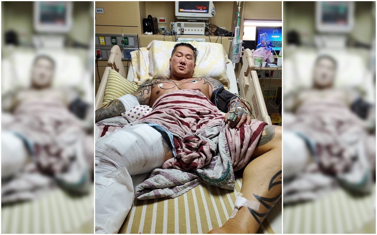 館長28日遭槍擊，手術後暫無大礙，目前仍在加護病房。（翻攝自飆捍臉書）