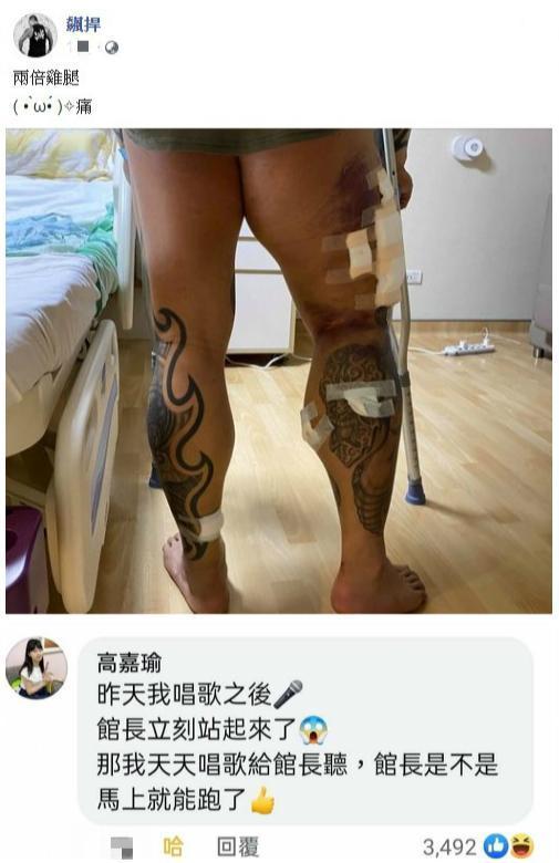 館長秀出「打斷手骨顛倒勇」再站起來的照片,曾獻唱探望的立委高嘉瑜留言:「那我天天唱歌給館長聽。」(翻攝自飆捍臉書)