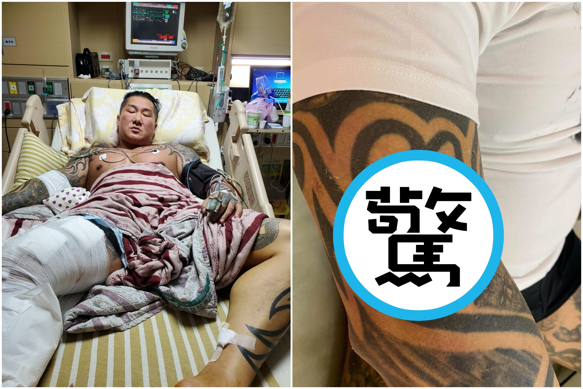 館長於臉書po出數張「槍傷彈痕照」，更留言強調「你可以摧毀我的肉體，但你無法摧毀我的意志。」（翻攝自飆捍臉書粉專）