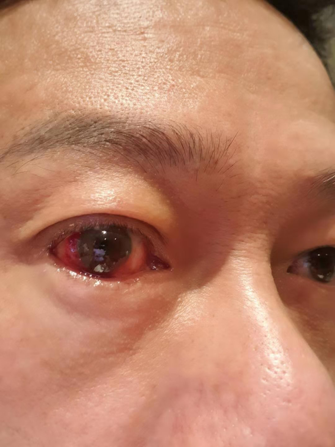 《馗降：粽邪2》在台上映，人還在廣州拍戲的李康生，突然眼睛充血，跟電影裡頭遭到附身的角色如出一轍。（翻攝自李康生臉書）