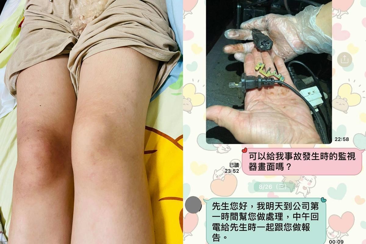 王姓女網友台南吃火鍋遭電擊,左腳癱瘓無知覺。(翻攝自臉書社團「爆料公社」)