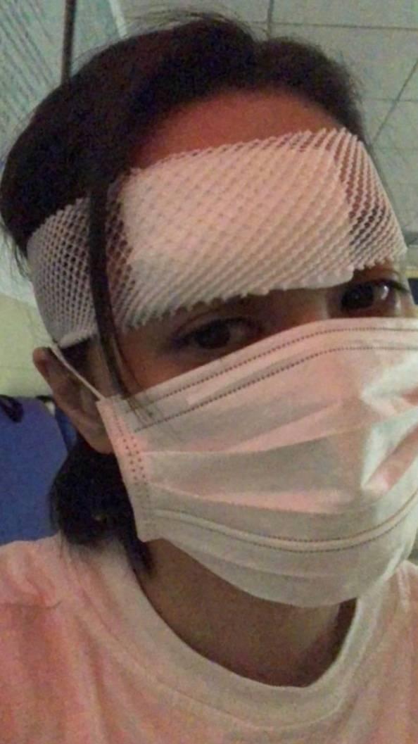 阿嬌日前撞傷頭，縫了數百針，頭部也包紮了繃帶。（翻攝自霍汶希微博）