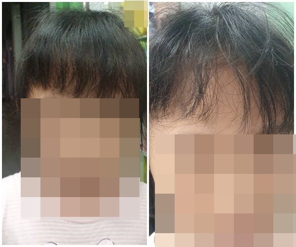 女童放學回家，瀏海歪斜、凌亂。（翻攝自臉書社團「抱怨公社」）