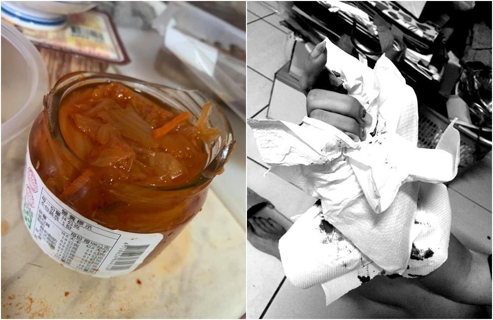 女子扭開罐頭,玻璃罐瓶身竟爆裂,導致她手指插滿玻璃送醫縫6針。(翻攝自「爆料公社」臉書社團)